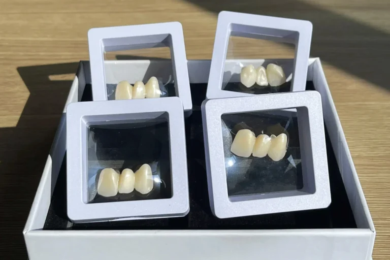 Zirconia Crowns Before and After Transformations: The Power of Precision